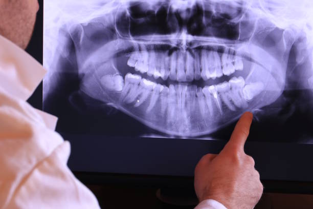 Best Holiday Emergency Dentist in Huntingtown, MD