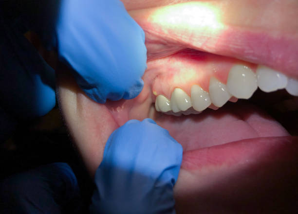 Best Weekend Emergency Dentist in Huntingtown, MD
