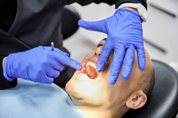 Best Broken or Cracked Tooth Emergency Dentist in Huntingtown, MD